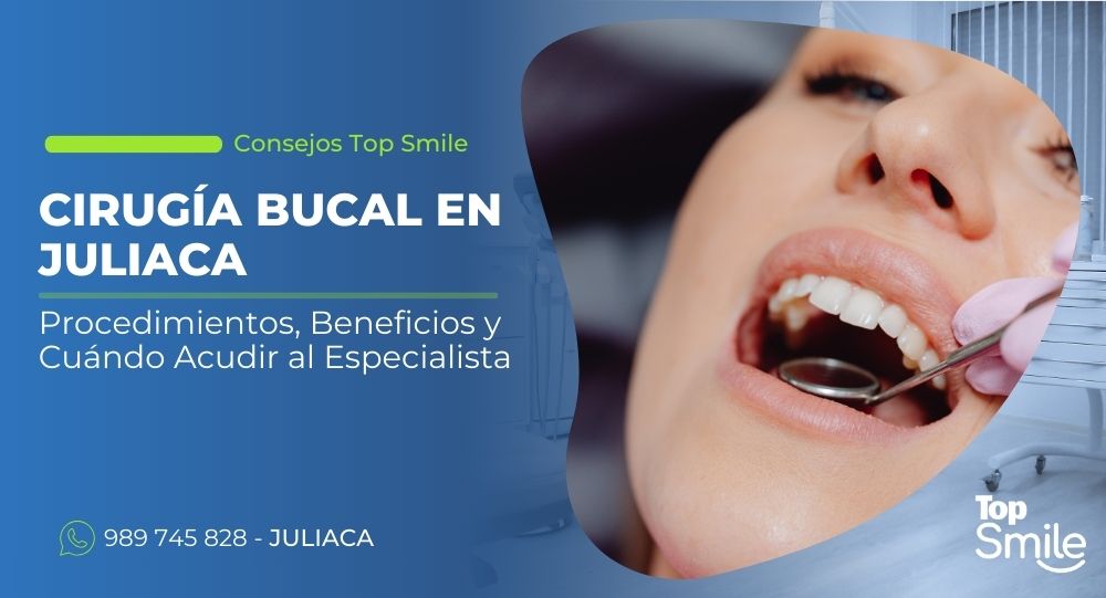 cirugía bucal en Juliaca
