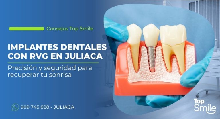 implantes dentales con RVG en Juliaca