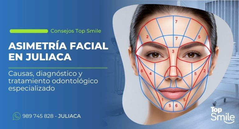 asimetría facial en Juliaca