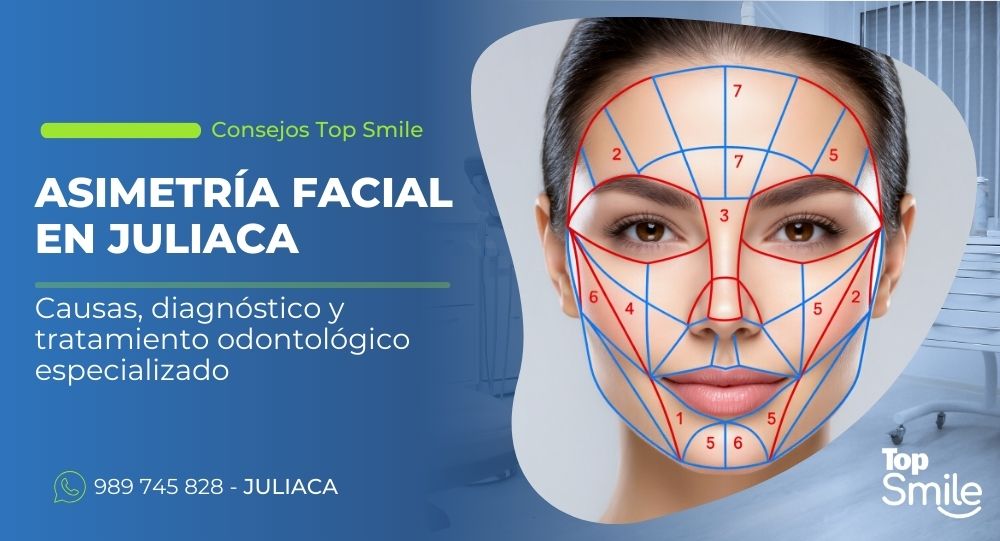 asimetría facial en Juliaca